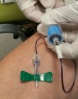 HCS incorpora Avanzado Procedimiento en Tratamiento de Lesiones Osteomusculares y Deportivas